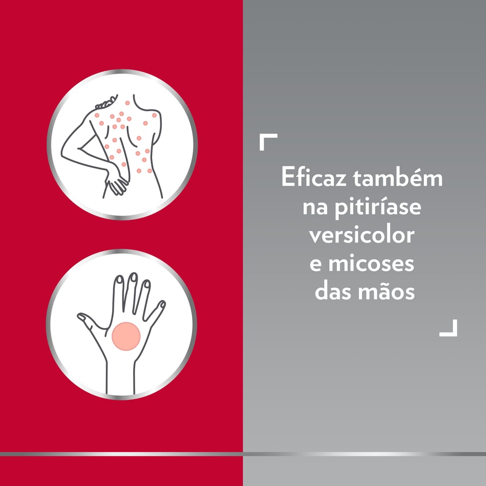 Canesten Unidia creme eficaz na pitiríase